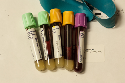 How Officers Test for Alcohol and Drugs in Your System